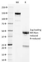 Alkaline Phosphatase (Placental)/PLAP (Germ Cell Tumor Marker) Antibody in SDS-PAGE (SDS-PAGE)