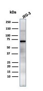 Alkaline Phosphatase (Placental)/PLAP (Germ Cell Tumor Marker) Antibody in Western Blot (WB)