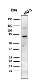 Alkaline Phosphatase (Placental)/PLAP (Germ Cell Tumor Marker) Antibody in Western Blot (WB)