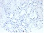 Alkaline Phosphatase (Placental)/PLAP (Germ Cell Tumor Marker) Antibody in Immunohistochemistry (Paraffin) (IHC (P))