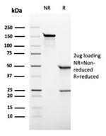 Alkaline Phosphatase (Placental)/PLAP (Germ Cell Tumor Marker) Antibody in SDS-PAGE (SDS-PAGE)