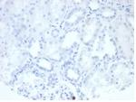 Alkaline Phosphatase (Placental)/PLAP (Germ Cell Tumor Marker) Antibody in Immunohistochemistry (Paraffin) (IHC (P))