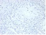 Alkaline Phosphatase (Placental)/PLAP (Germ Cell Tumor Marker) Antibody in Immunohistochemistry (Paraffin) (IHC (P))