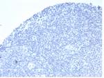 Alkaline Phosphatase (Placental)/PLAP (Germ Cell Tumor Marker) Antibody in Immunohistochemistry (Paraffin) (IHC (P))