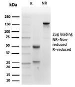 Alkaline Phosphatase (Placental)/PLAP Antibody in SDS-PAGE (SDS-PAGE)