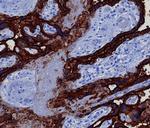 Alkaline Phosphatase (Placental)/PLAP (Germ Cell Tumor Marker) Antibody in Immunohistochemistry (Paraffin) (IHC (P))