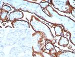 Alkaline Phosphatase (Placental)/PLAP (Germ Cell Tumor Marker) Antibody in Immunohistochemistry (Paraffin) (IHC (P))