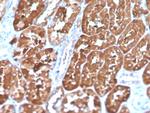 Ferritin, Light Chain (Node-Negative Breast Tumor Prognostic Marker) Antibody in Immunohistochemistry (Paraffin) (IHC (P))