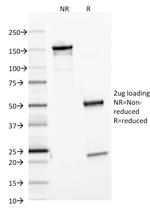 Ferritin, Light Chain (Node-Negative Breast Tumor Prognostic Marker) Antibody in SDS-PAGE (SDS-PAGE)