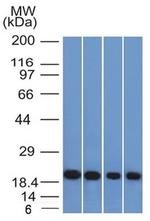 Ferritin, Light Chain Antibody in Western Blot (WB)