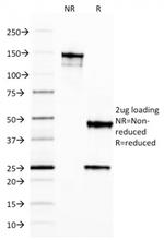 Ferritin, Light Chain (Node-Negative Breast Tumor Prognostic Marker) Antibody in SDS-PAGE (SDS-PAGE)