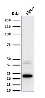 Ferritin, Light Chain (Node-Negative Breast Tumor Prognostic Marker) Antibody in Western Blot (WB)