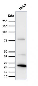 Ferritin, Light Chain Antibody in Western Blot (WB)