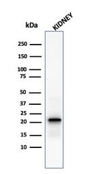 Ferritin, Light Chain Antibody in Western Blot (WB)