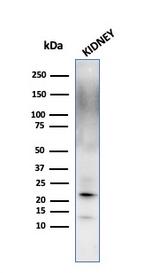 Ferritin, Light Chain Antibody in Western Blot (WB)