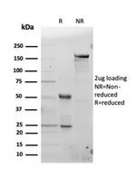 Ferritin, Light Chain Antibody in SDS-PAGE (SDS-PAGE)