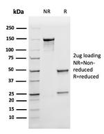 Ferritin, Light Chain (Node-Negative Breast Tumor Prognostic Marker) Antibody in SDS-PAGE (SDS-PAGE)