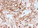 Ferritin, Light Chain (Node-Negative Breast Tumor Prognostic Marker) Antibody in Immunohistochemistry (Paraffin) (IHC (P))