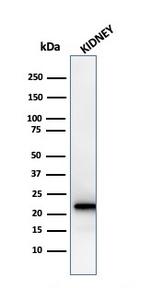 Ferritin, Light Chain (Node-Negative Breast Tumor Prognostic Marker) Antibody in Western Blot (WB)