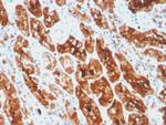 Ferritin, Light Chain (Node-Negative Breast Tumor Prognostic Marker) Antibody in Immunohistochemistry (Paraffin) (IHC (P))