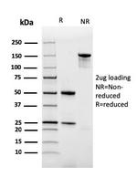 Ferritin, Light Chain (Node-Negative Breast Tumor Prognostic Marker) Antibody in SDS-PAGE (SDS-PAGE)