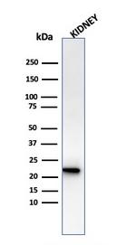 Ferritin, Light Chain (Node-Negative Breast Tumor Prognostic Marker) Antibody in Western Blot (WB)