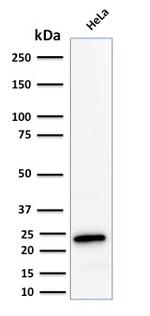 Ferritin, Light Chain (FTL) Antibody in Western Blot (WB)