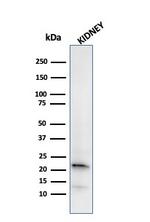 Ferritin, Light Chain (FTL) Antibody in Western Blot (WB)