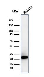 Ferritin, Light Chain Antibody in Western Blot (WB)