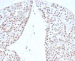 Steroidogenic Factor 1 (SF-1) Antibody in Immunohistochemistry (Paraffin) (IHC (P))