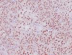 Steroidogenic Factor 1 (SF-1) Antibody in Immunohistochemistry (Paraffin) (IHC (P))