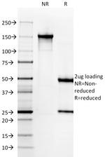 Gastrin Antibody in SDS-PAGE (SDS-PAGE)