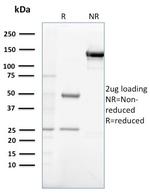 Gastrin Antibody in SDS-PAGE (SDS-PAGE)