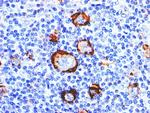 CD15/FUT4 (Reed-Sternberg Cell Marker) Antibody in Immunohistochemistry (Paraffin) (IHC (P))