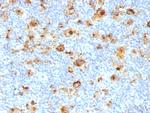 CD15/FUT4 (Reed-Sternberg Cell Marker) Antibody in Immunohistochemistry (Paraffin) (IHC (P))