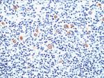 CD15/FUT4 (Reed-Sternberg Cell Marker) Antibody in Immunohistochemistry (Paraffin) (IHC (P))