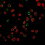 CD15/FUT4 (Reed-Sternberg Cell Marker) Antibody in Immunocytochemistry (ICC/IF)