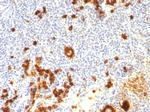 CD15/FUT4 (Reed-Sternberg Cell Marker) Antibody in Immunohistochemistry (Paraffin) (IHC (P))