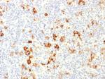 CD15/FUT4 (Reed-Sternberg Cell Marker) Antibody in Immunohistochemistry (Paraffin) (IHC (P))