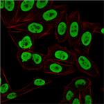 Ku (p70/p80) (Nuclear Marker) Antibody in Immunocytochemistry (ICC/IF)