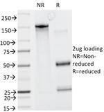 HGAL (Human Germinal Center Associated Lymphoma Marker) Antibody in SDS-PAGE (SDS-PAGE)