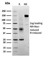 SERBP1/PAI-RBP1 Antibody in SDS-PAGE (SDS-PAGE)