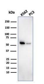 SERBP1/PAI-RBP1 Antibody in Western Blot (WB)