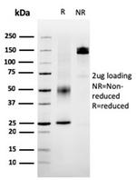 SERBP1/PAI-RBP1 Antibody in SDS-PAGE (SDS-PAGE)