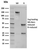 SERBP1/PAI-RBP1 Antibody in SDS-PAGE (SDS-PAGE)