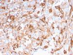 SERBP1/PAI-RBP1 Antibody in Immunohistochemistry (Paraffin) (IHC (P))