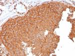 SERBP1/PAI-RBP1 Antibody in Immunohistochemistry (Paraffin) (IHC (P))