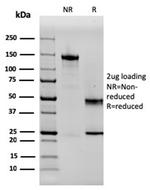 SERBP1/PAI-RBP1 Antibody in SDS-PAGE (SDS-PAGE)