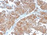 SERBP1/PAI-RBP1 Antibody in Immunohistochemistry (Paraffin) (IHC (P))