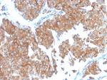 SERBP1/PAI-RBP1 Antibody in Immunohistochemistry (Paraffin) (IHC (P))